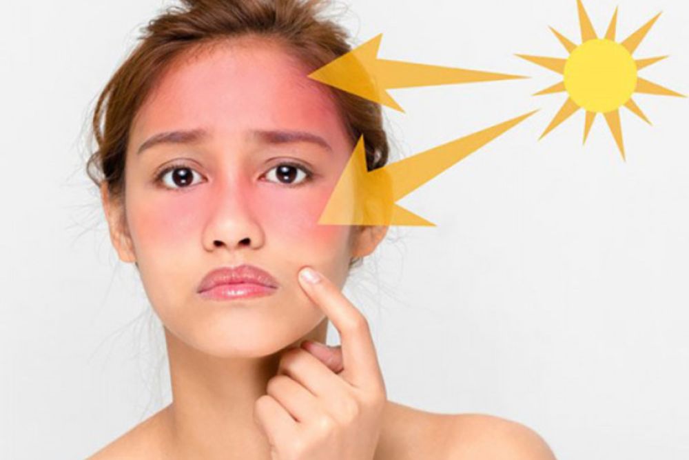 Da dễ bị ảnh hưởng bởi nắng nóng, bụi bẩn và mất cân bằng trong mùa hè.