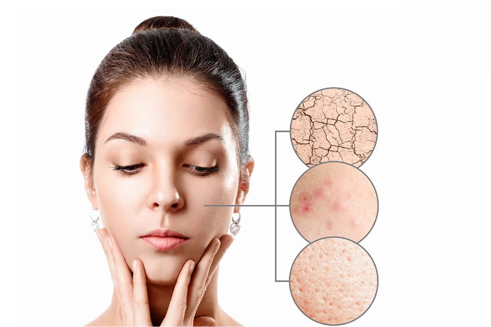 Khi da gặp vấn đề cần phục hồi và làm sạch sâu.