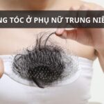 Rụng tóc ở phụ nữ trung niên